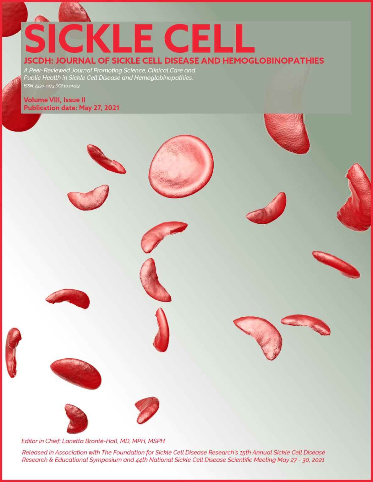 research paper on sickle cell disease